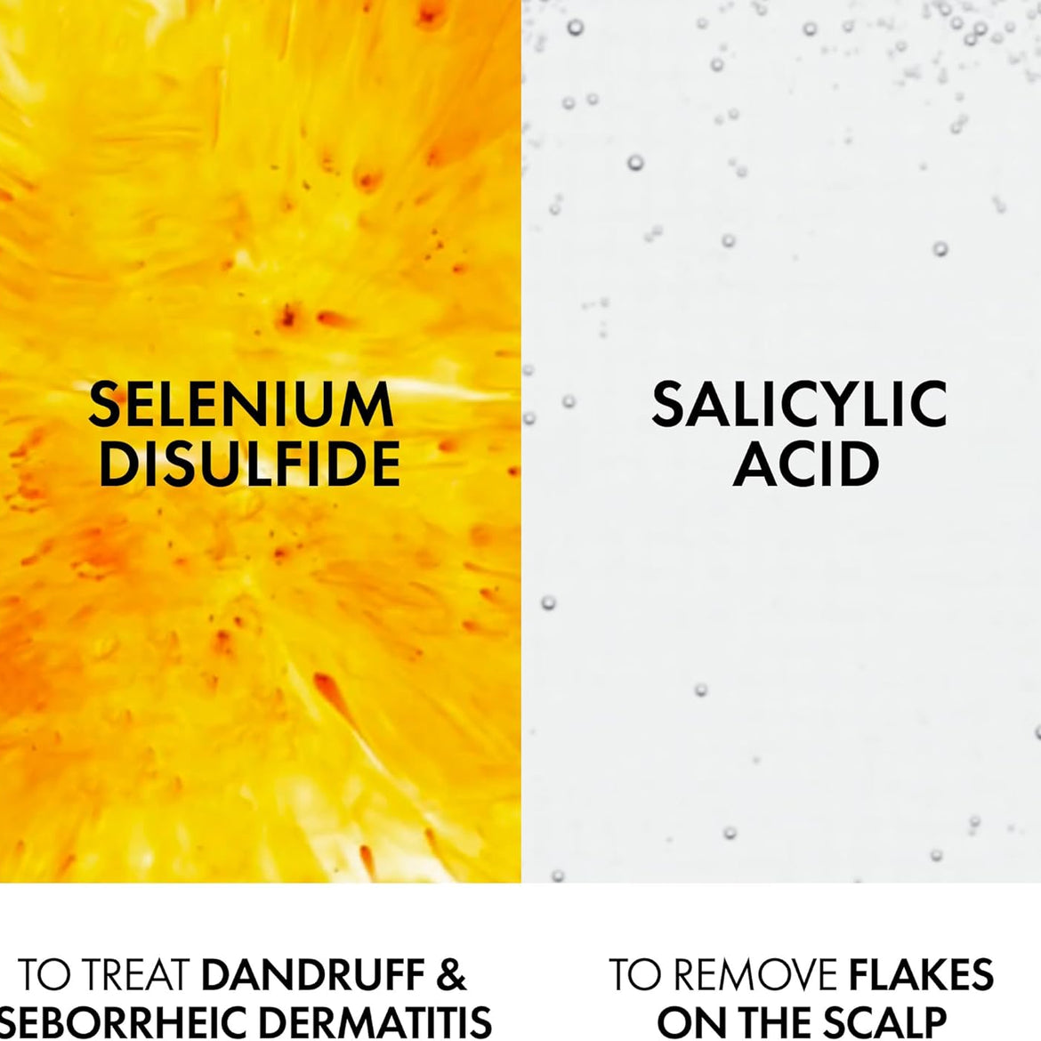 Vichy Dercos Anti Dandruff Shampoo for Dry hair