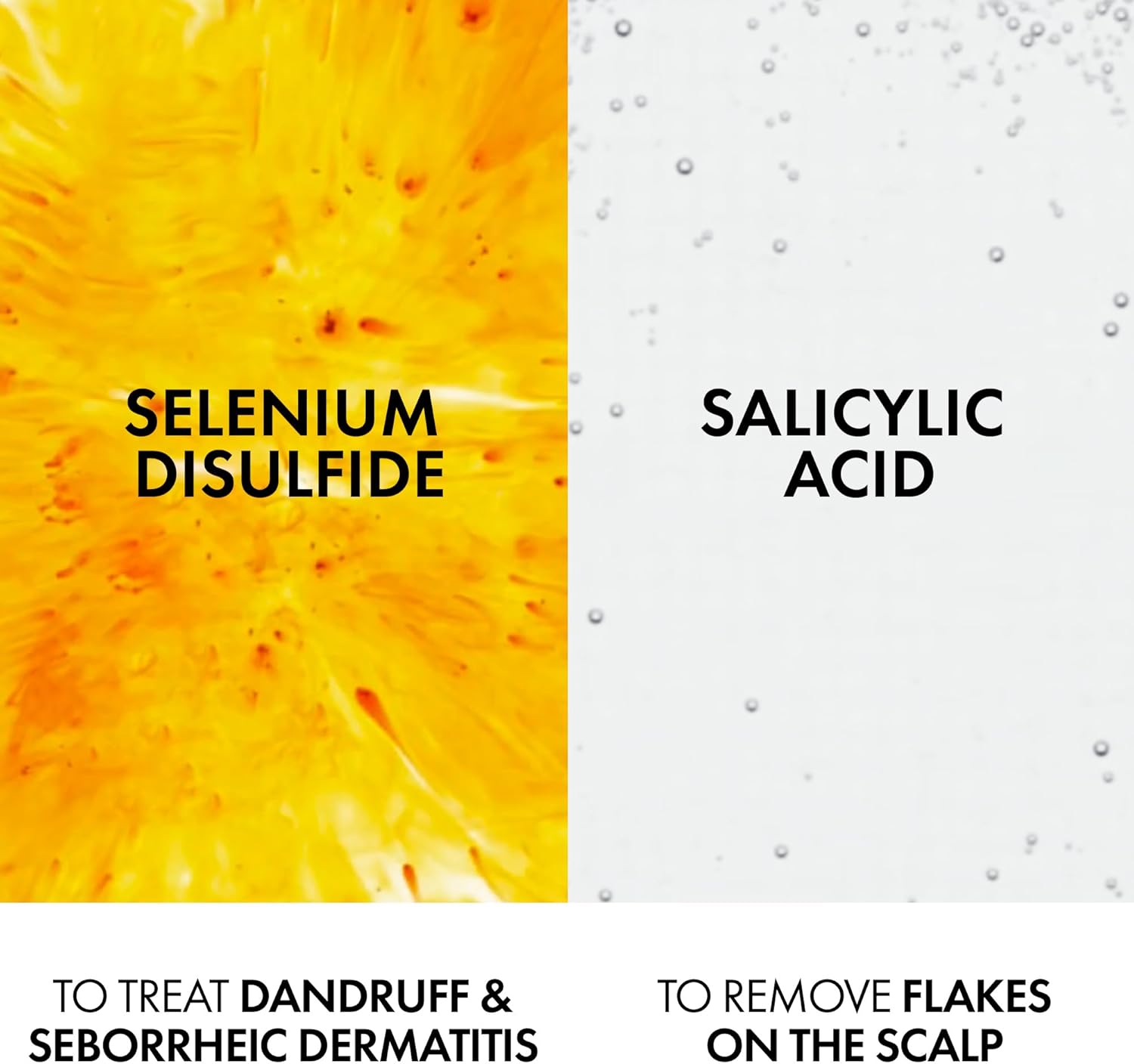 Vichy Dercos Anti Dandruff Shampoo for Dry hair