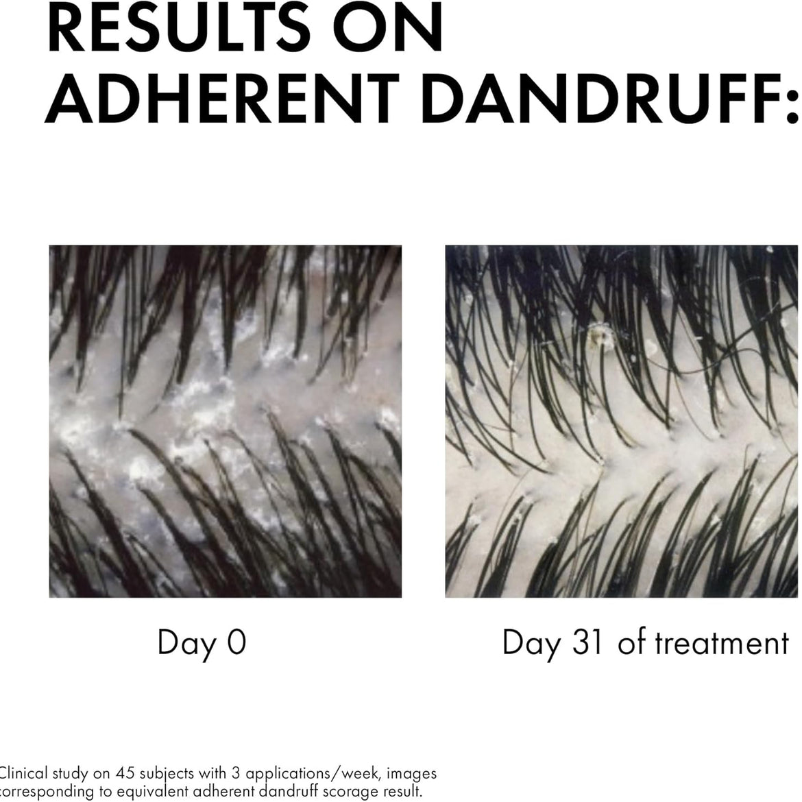 Vichy Dercos Anti Dandruff Shampoo for Dry hair