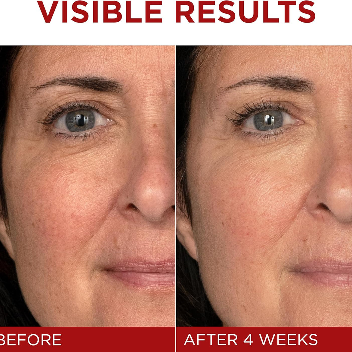 L'OREAL PARIS Skincare Revitalift Triple Power Anti-Aging Face Moisturizer with Pro Retinol, Hyaluronic Acid & Vitamin C to reduce wrinkles, firm and brighten skin, 1.7 Oz - (Packaging May Vary)